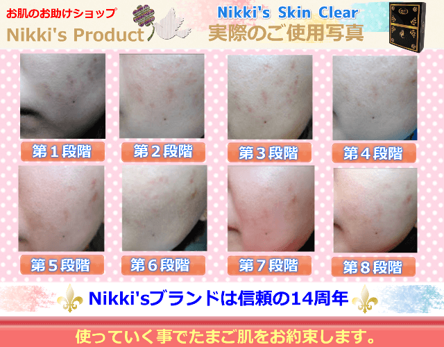 Nikki's Skin Clear　使用例１