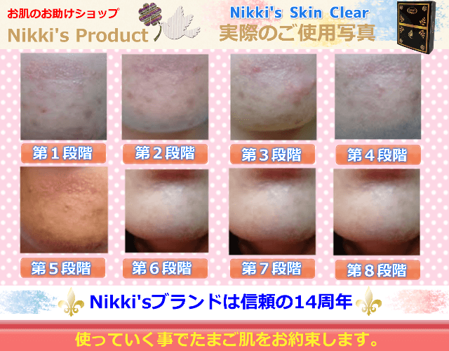 Nikki's Skin Clear　使用例２