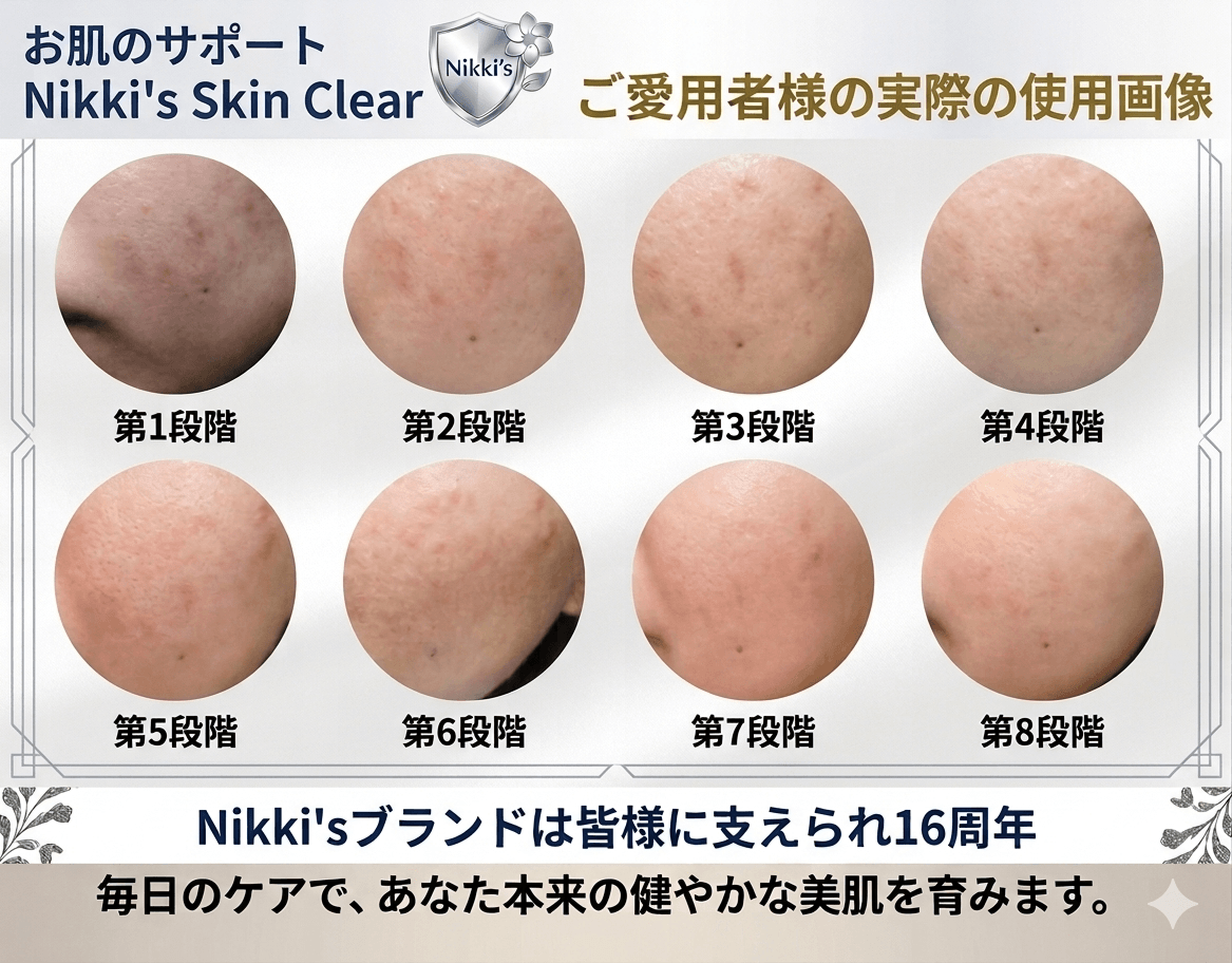 ニッキーズスキンクリア Nikki's Skin Clear 通常使用 (シミ、そばかす