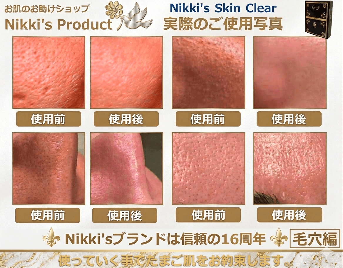 ニッキーズスキンクリア Nikki's Skin Clear 通常使用 (シミ、そばかす