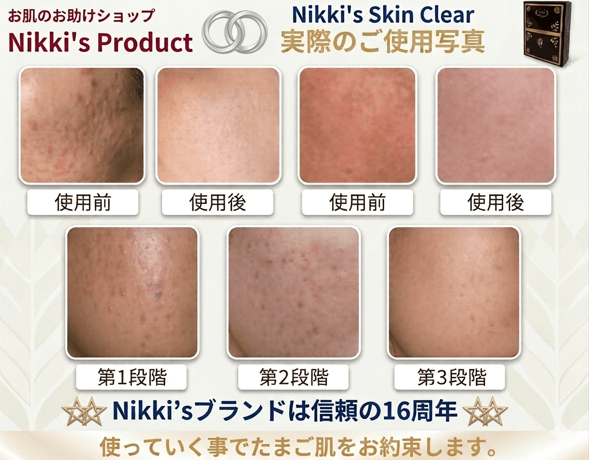 ニッキーズスキンクリア Nikki's Skin Clear 通常使用 (シミ、そばかす