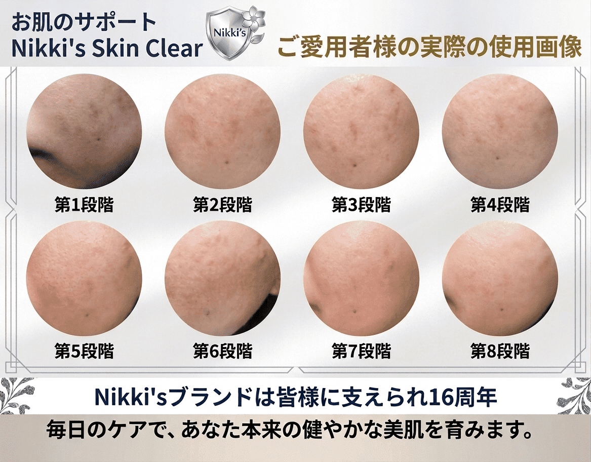 ニッキーズスキンクリア　通常使用３本　石鹸　未使用品 ニッキーズスキンクリア Nikki's Skin Clear 通常使用 (シミ、そばかす