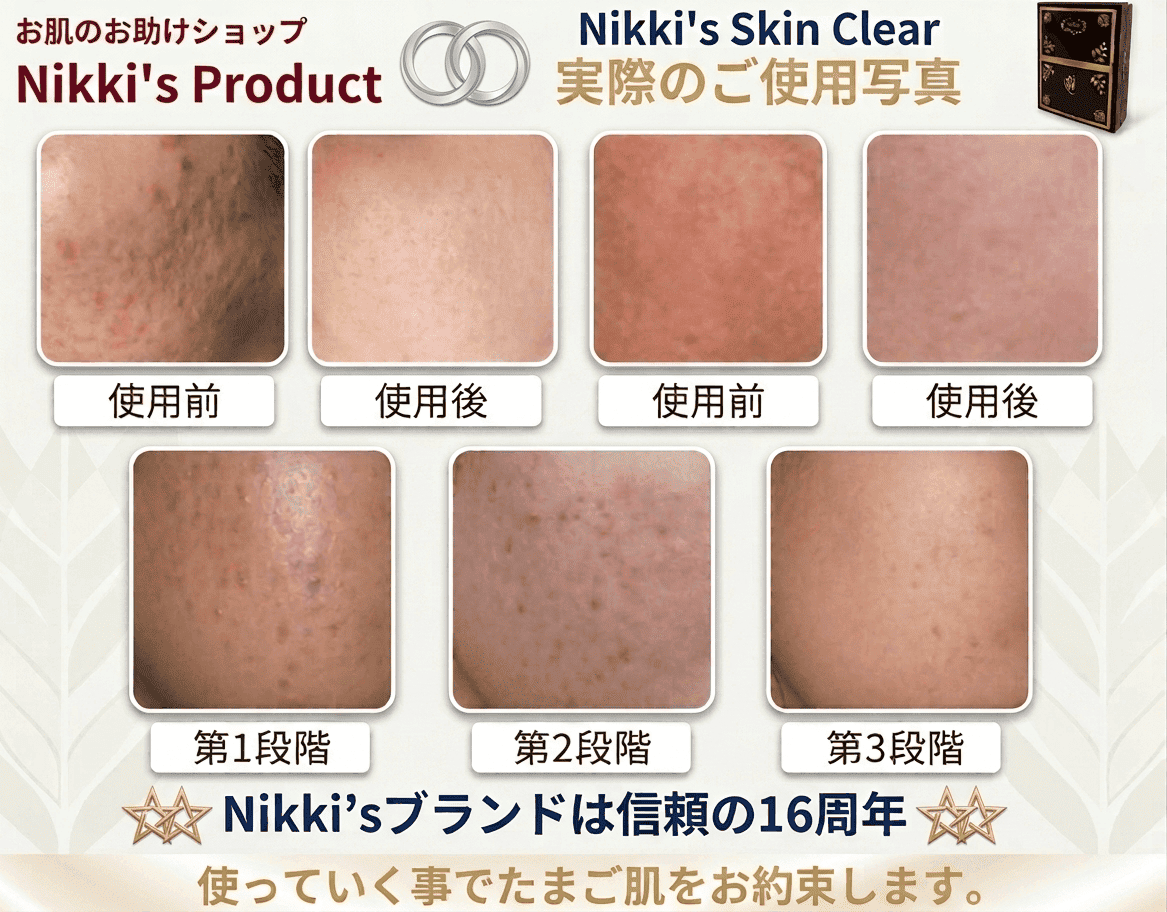 ニッキーズスキンクリア Nikki's Skin Clear 通常使用 (シミ、そばかす