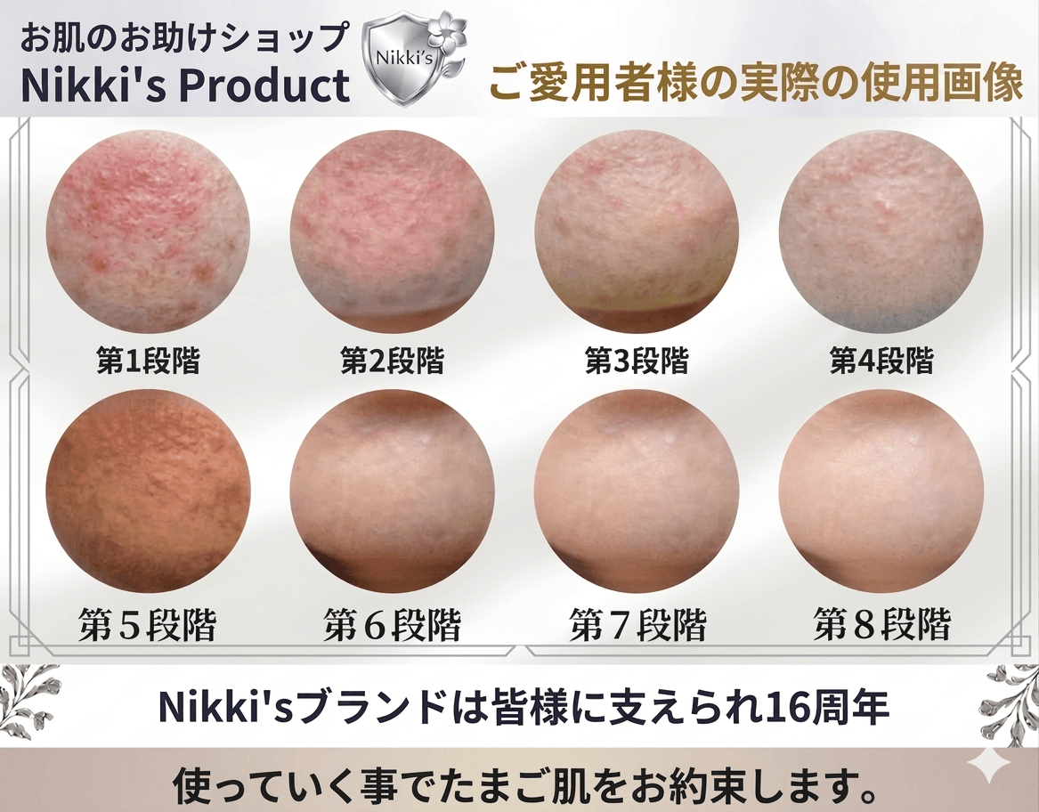 最新到着分　しみ、ニキビ跡、毛穴　噂のNikki's Skin Clear　通常 ニッキーズスキンクリア Nikki's Skin Clear 通常使用 (シミ、そばかす