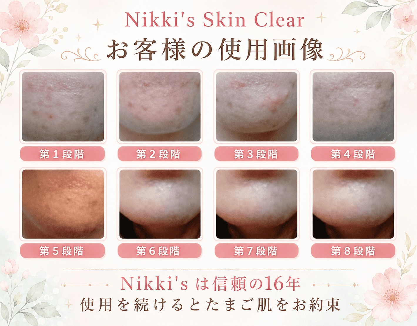 ニキビ跡、毛穴、しみ、そばかす　噂のNikki's Skin Clear 通常版 ニッキーズスキンクリア Nikki's Skin Clear 通常使用 (シミ、そばかす