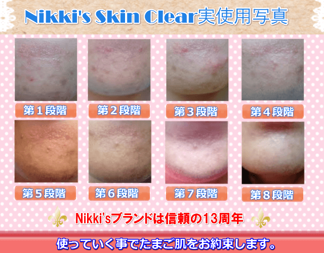 Nikki's Skin Clear 通常使用 (シミ、そばかす、にきび、傷跡 